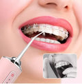 Irrigador dental profesional (colores variado) - additional image 2
